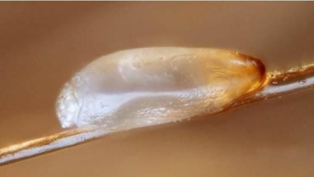 80年代人头上为什么有好多虱子,为什么90年代的人有虱子