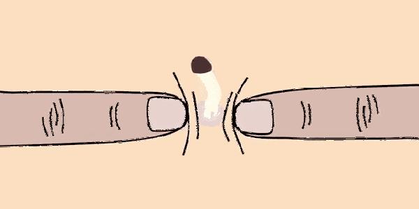 鼻子上的黑头的正确处理方法,鼻子上的黑头越来越严重怎么办