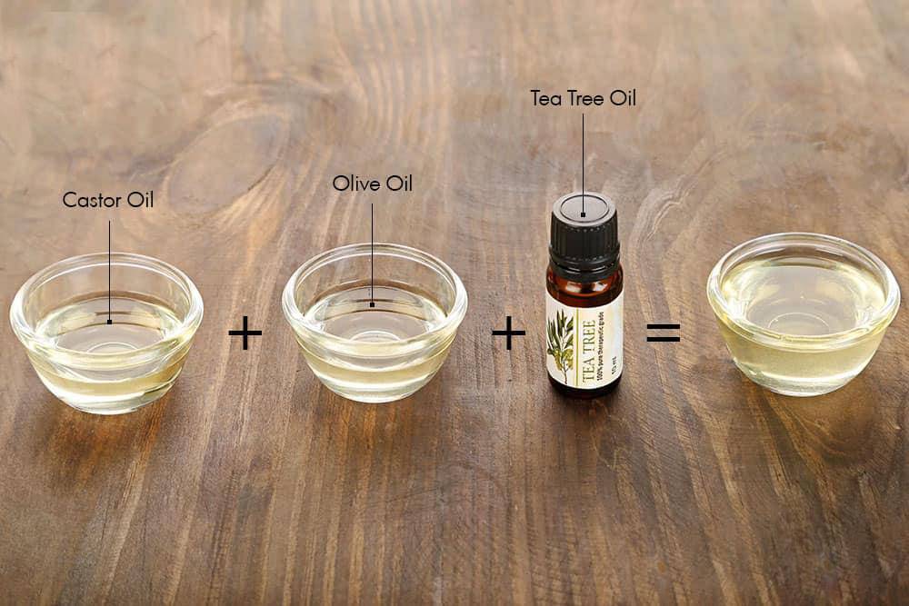 祛痘印不刺激药膏,祛痘印精华不用避光使用