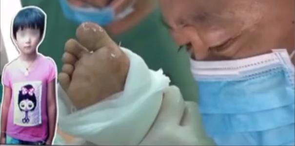 8岁女孩罕见怪病后续,8岁女孩罕见怪病