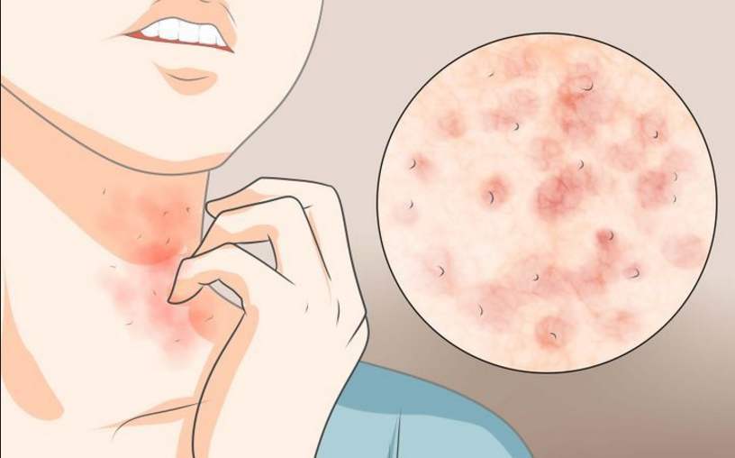 食盐和白醋一起用能杀菌吗,食盐和白醋有固定颜色的功效吗