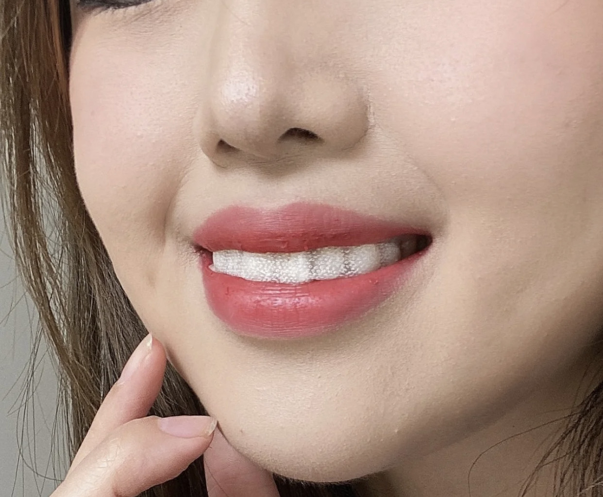 无危害的牙贴,市面上卖的美牙贴管用吗