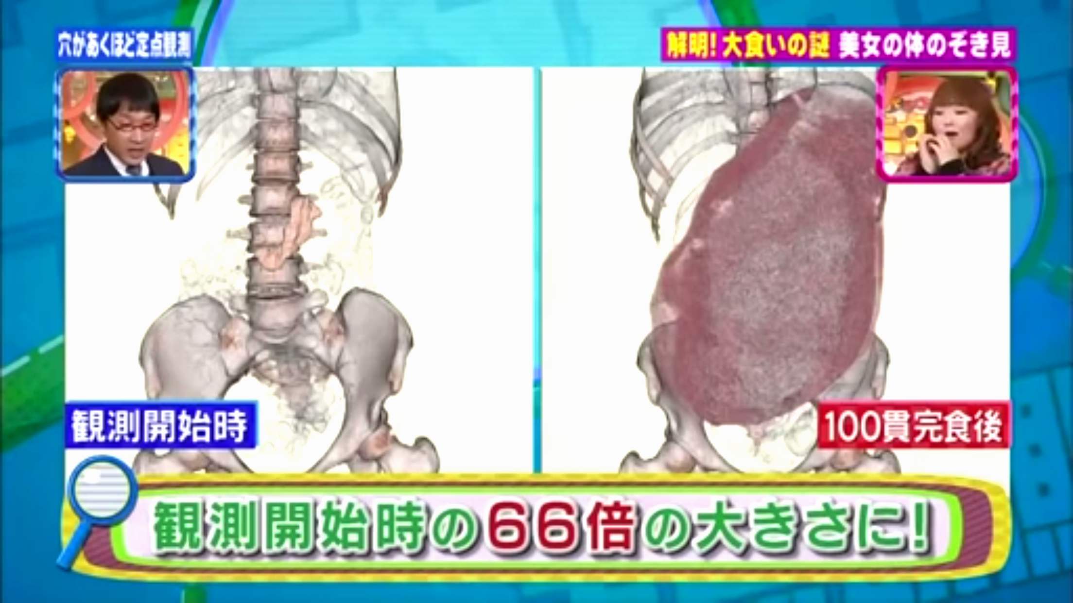 大胃王的胃真的很大吗？呕吐的过程是怎样的，干嘛难为自己呢？