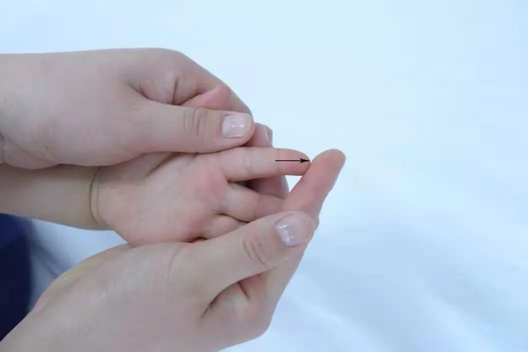 新生儿去黄疸小儿推拿,小儿推拿治疗黄疸的视频