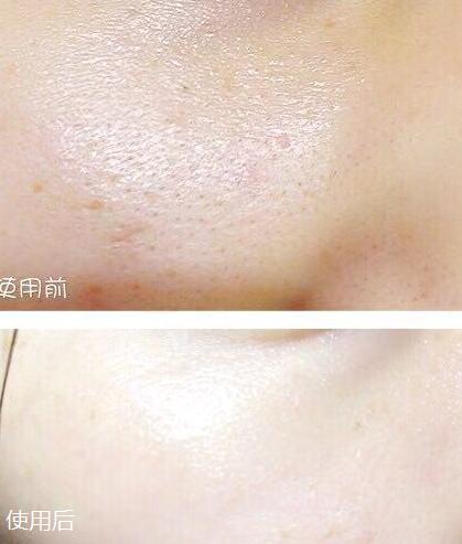 零毛孔让你的皮肤光滑细腻,教你一招搞定毛孔