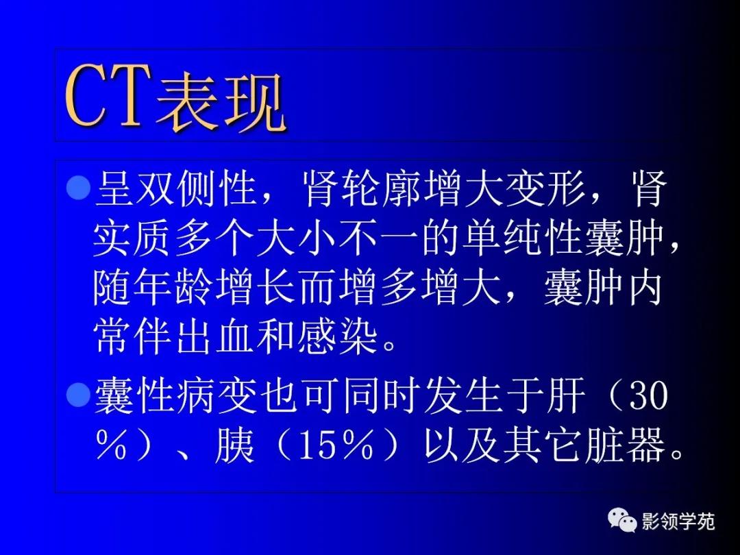 肾脏囊性肿块的影像学特点,肾脏典型病理图片及解析