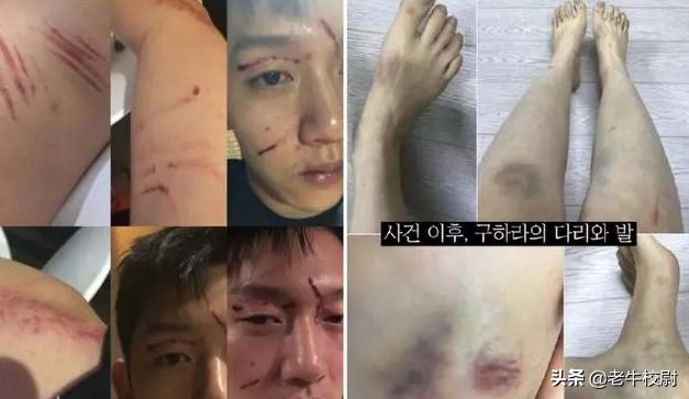 雪莉闺蜜、知名韩女星具荷拉自杀，真相究竟是什么？