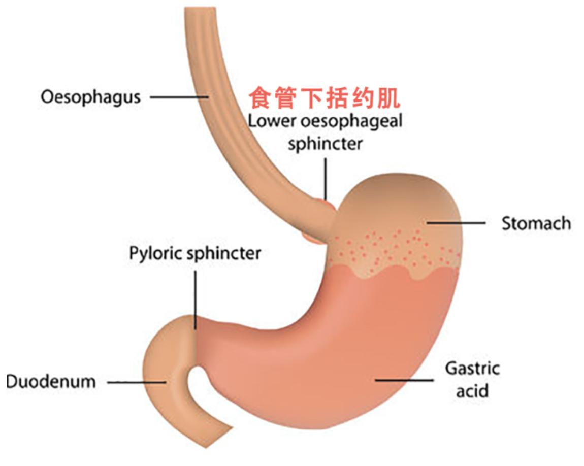 为何烧心,为什么反酸治不了