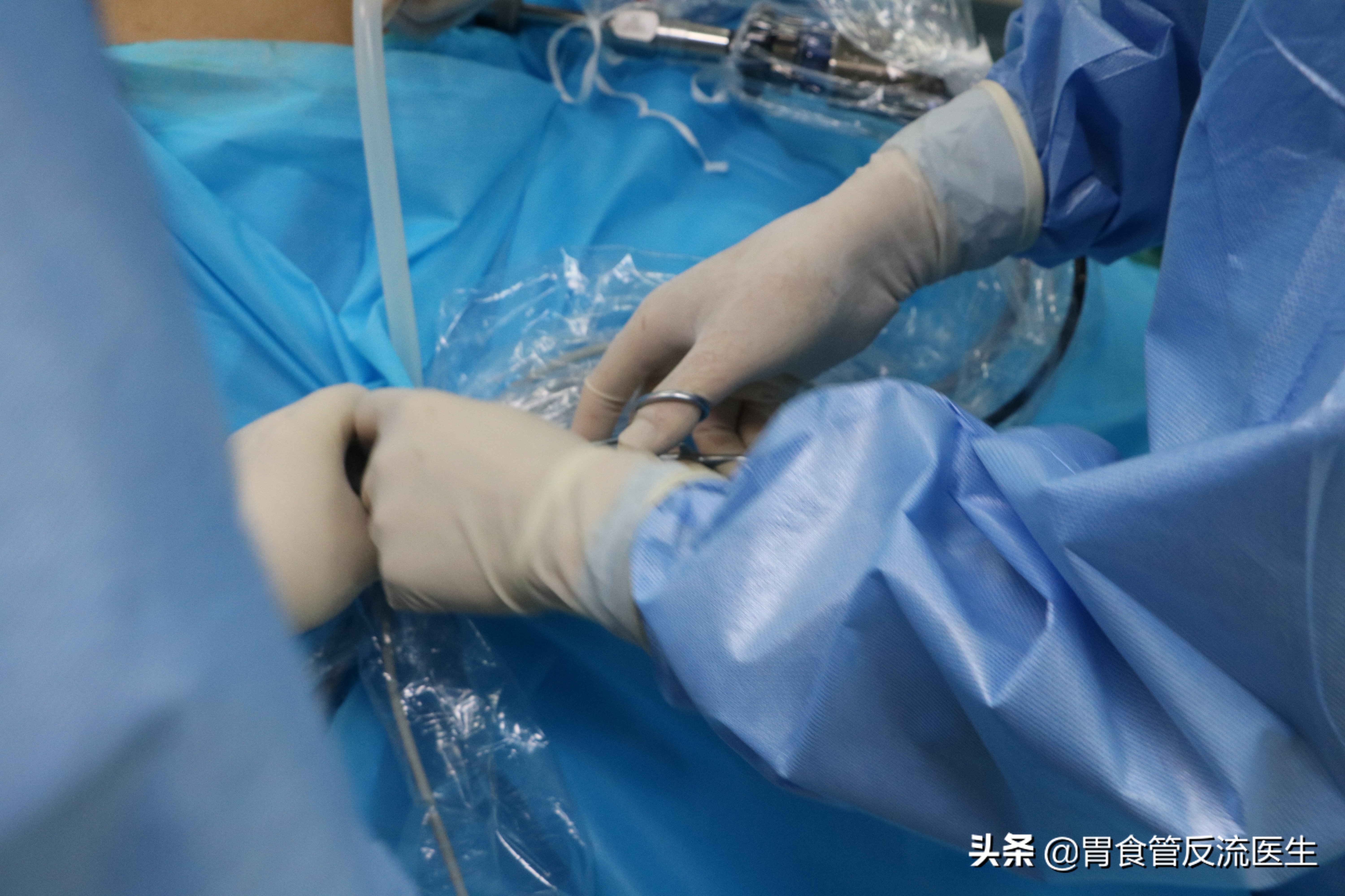 胃食管反流引起咽喉痛怎么治,胃食管反流咽喉痛怎么治疗