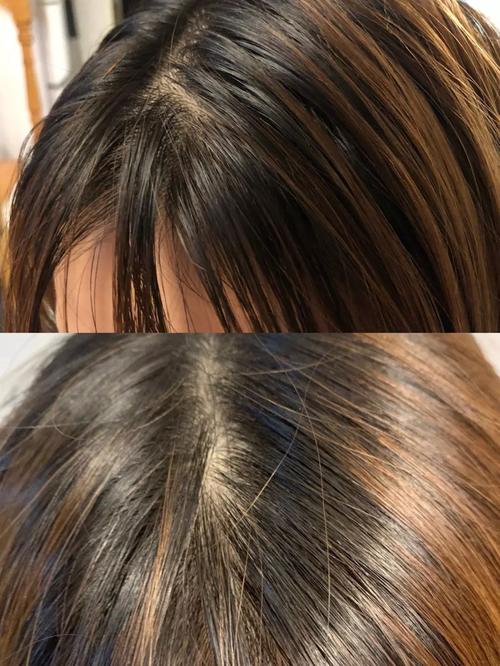 沙宣洗发水掉头发,沙宣洗发水洗了脱发