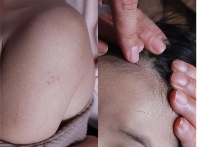 河南女童遭扎后续,河南女童幼儿园事件官方通报