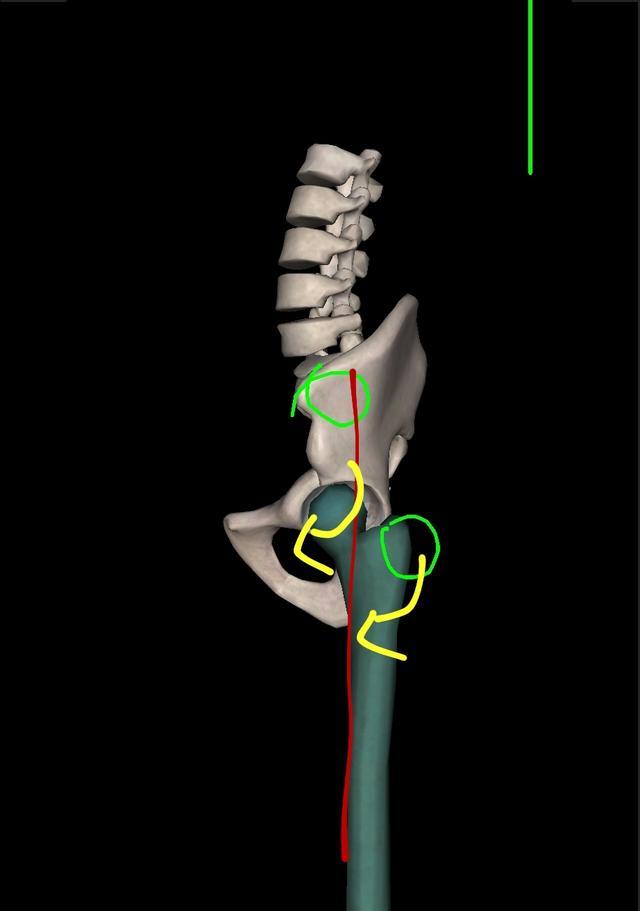 你以为自己骨架大腿又短，其实是假胯宽造成的，自己完全可以调整