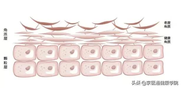刷酸注意事项及使用方法,刷酸的弊端