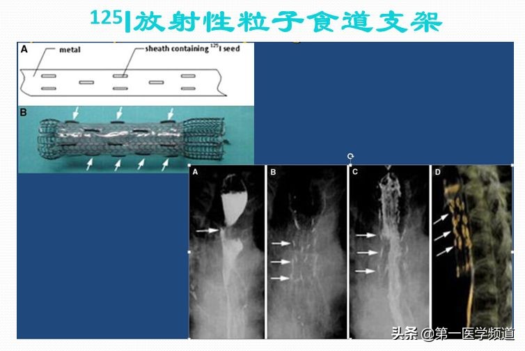 「医影传声」上海交通大学医学院附属瑞金医院卢湾分院放射科主任
