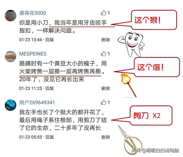 一招处理瘊子,无公害处理瘊子