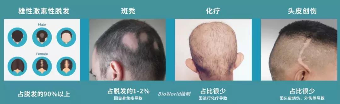 诺奖成果,头发再生最新研究成果