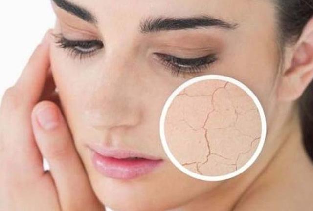 室内干燥不用加湿器怎么办,屋里干燥不用加湿器怎样增加湿度