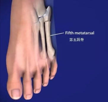 国足官宣武磊张玉宁,国足张玉宁伤情严重吗