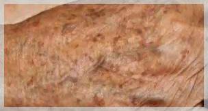 ​真是个“斑”脚石！（上集）