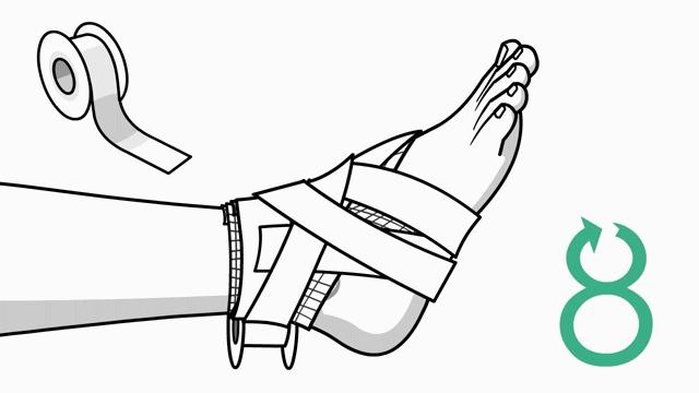 崴脚了用什么加压包扎,打篮球崴脚加压包扎