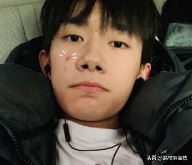 脸上痘痘爆脓怎么处理,小孩脸上痘痘怎么处理