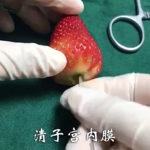 30岁人流的危害究竟有多大,人流的危害到底有多大