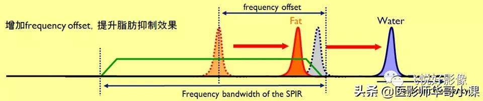 飞利浦磁共振独有技术,飞利浦磁共振减影技术
