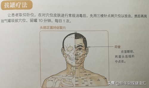 癫痫跟情绪有关系吗,癫痫并不可怕其实多半可以治愈