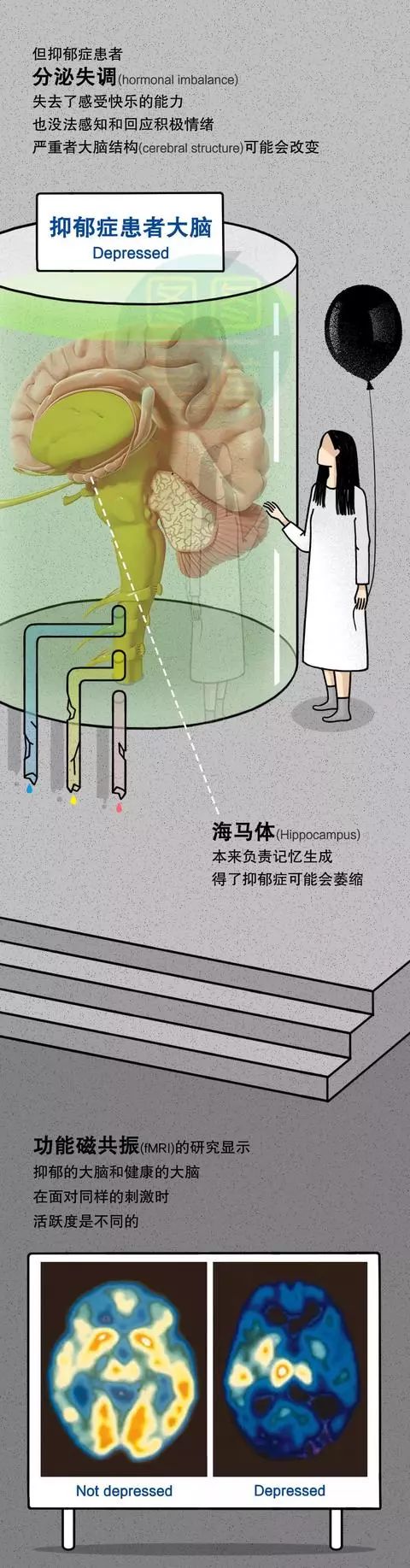 中学生抑郁症怎么自愈最快最有效,抑郁症能自我痊愈吗