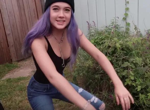 束腰导致内脏下垂漏尿,子宫脱落内脏下垂