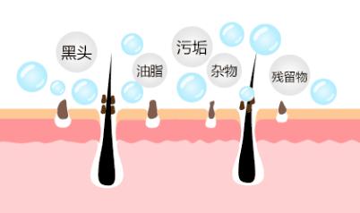 脸上长痘痘的原因和注意事项,脸上长痘痘到底应该怎么解决