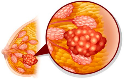 宝宝长期便秘十大危害,长期便秘十大危害