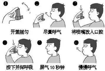 慢阻肺吸入气雾剂必须坚持用药吗,慢阻肺用什么气雾剂