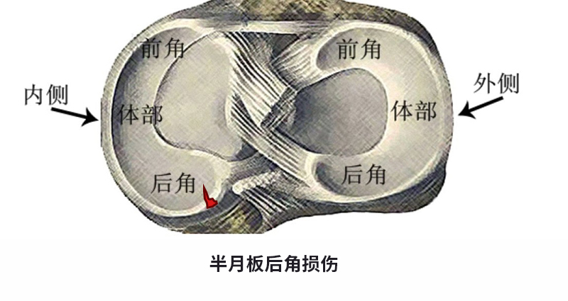 老人膝盖疼是滑膜炎吗,老年膝关节退变怎么治疗