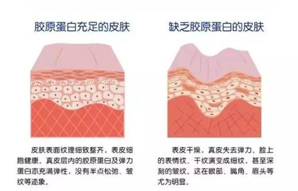女人法令纹怎么护肤好得快,女生长法令纹怎么安慰
