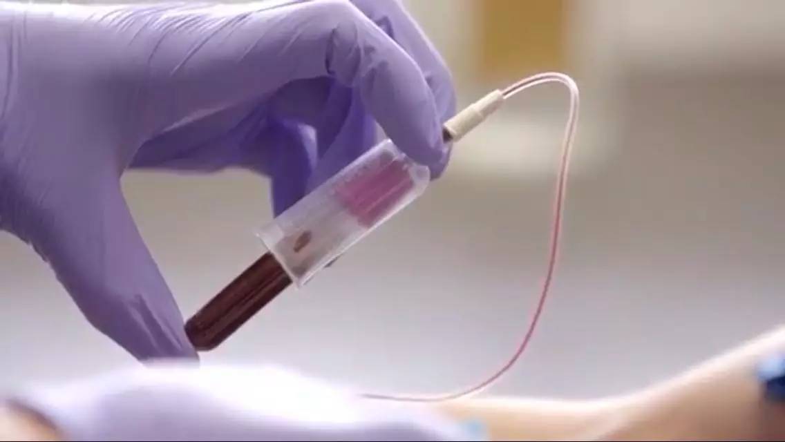 检查性激素6项医生问结婚没有,性激素六项化验单解读备孕