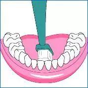 牙齿里面有一圈黄黄的用什么牙膏,牙齿表面有黄色的东西是什么原因