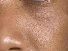 超人气卸妆,超级平价卸妆产品