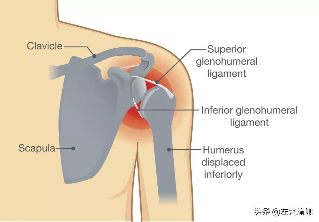 请停止过度“开肩”了！你的肩关节正在*吟呻**...