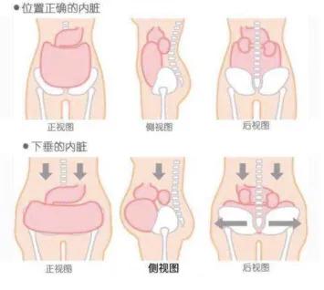产后腰痛骨盆痛如何缓解,产后妈妈腹部痛怎么回事