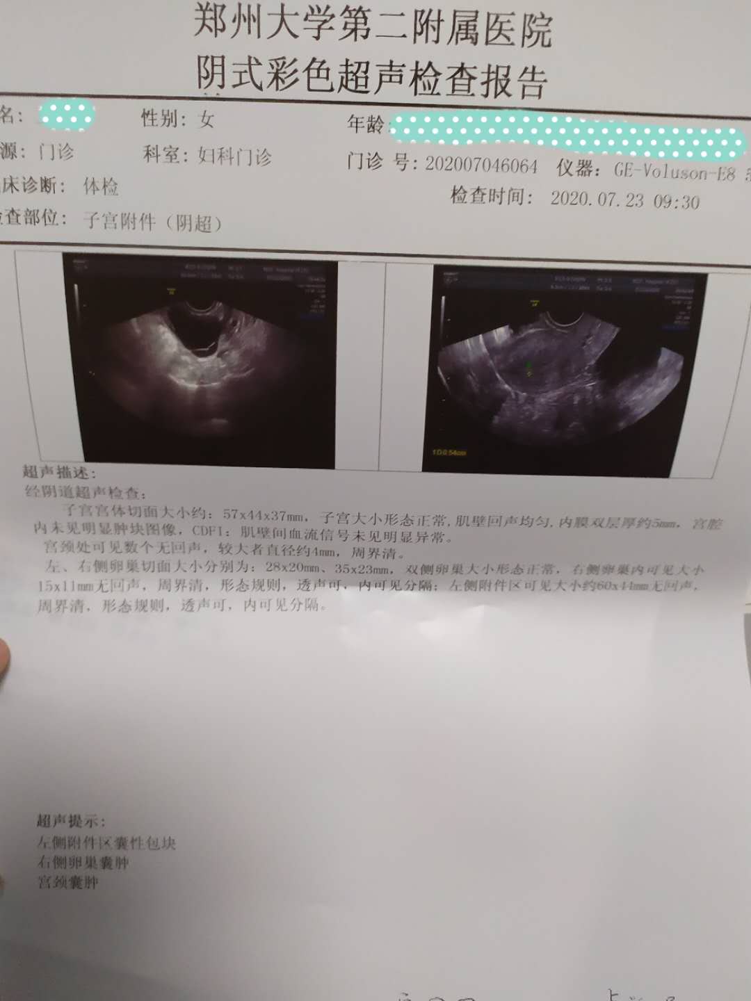 卵巢囊肿30x25mm如何治疗,卵巢囊肿的治疗方式最好的是什么