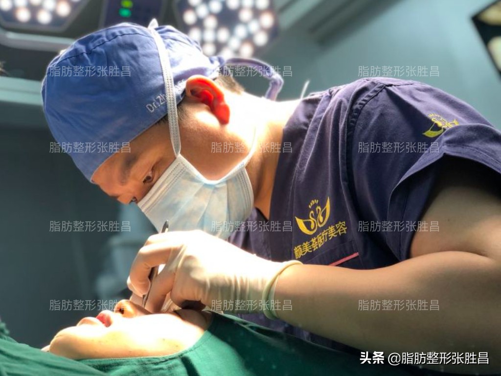 自体脂肪面部填充效果能保持多久,用自体脂肪面部填充怎样才算成功