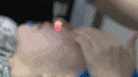 激光美容小知识,激光美容会不会导致脸部下垂