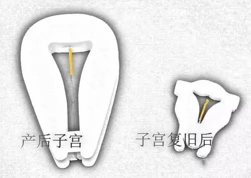 健康避孕小知识,产后避孕的十大建议