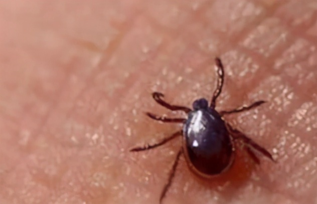 专家提示春夏出游谨防被蜱虫咬伤,老太被恙虫咬了险丧命