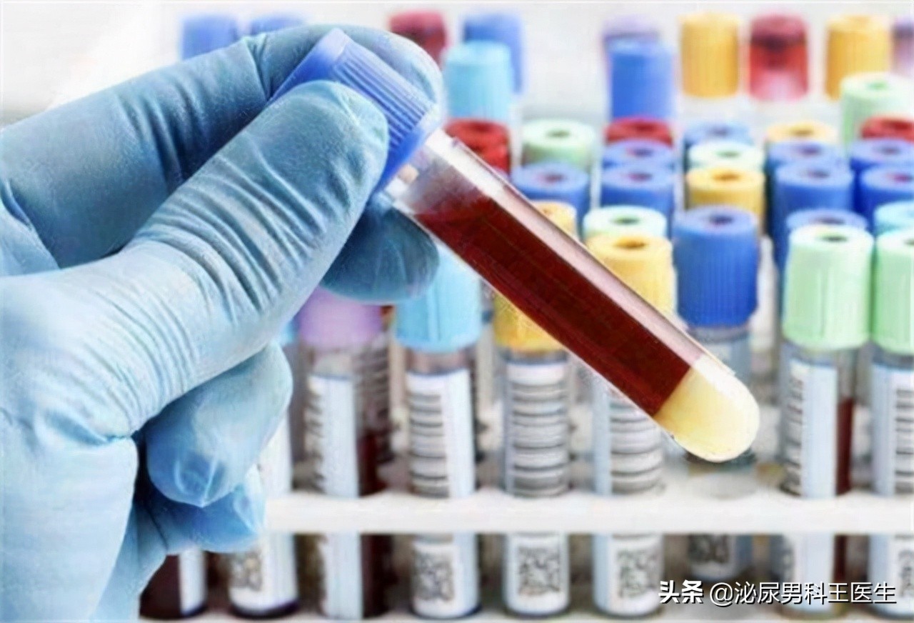 女人绝经后，必须要补充雌激素吗？