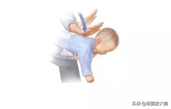 几个月宝宝吃东西被卡怎么办,大人被卡住急救方法能拍背吗