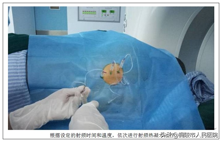 市人民医院医学影像科,德州市人民医院微创介入中心