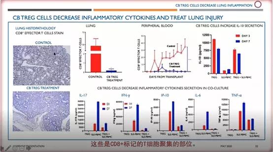 癌症中心SimritParmar教授：脐带血的最新应用