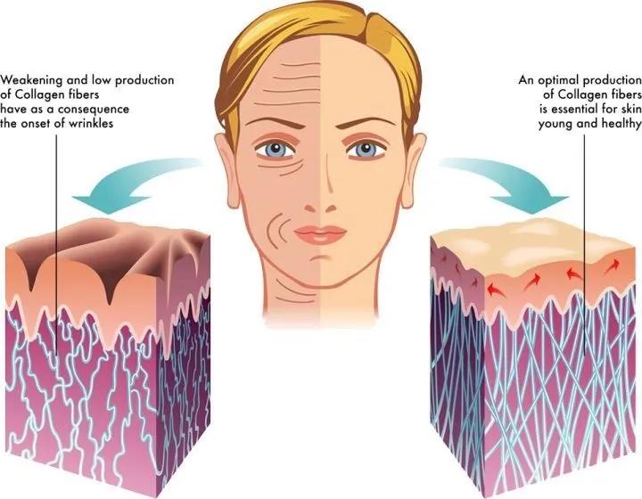 口服胶原蛋白到底有没有效,喝的胶原蛋白到底有效吗